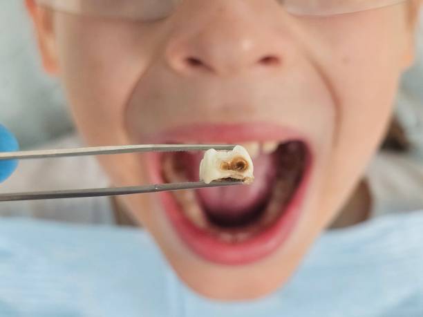 Best Urgent Dental Care for Toothaches in St Leon, IN